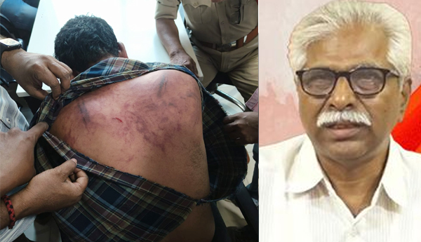 cpm condemn attack on Andhra Jyoti photographer